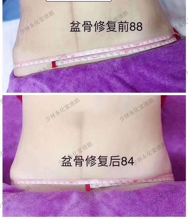   ���������îa(ch��n)���Ŀ-�����ޏ�