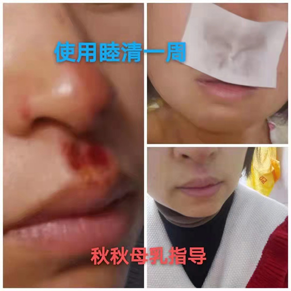 �����澏���N���Æ᣿���M(f��i)�߿ڱ���������(sh��)���a(ch��n)ƷȦ�۟o��(sh��)